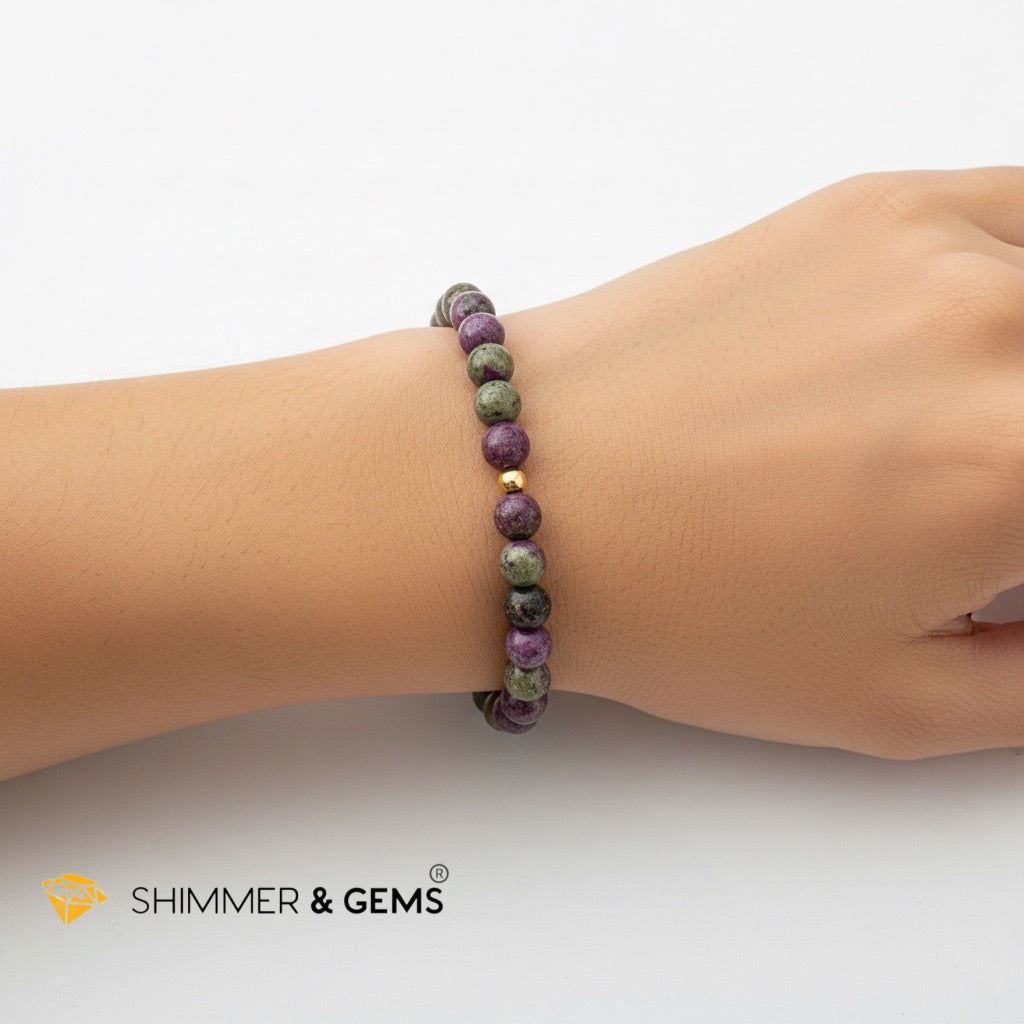 Atlantisite (Stichtite) Bracelet – 6mm